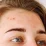 Problematic and acneic skin
