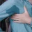 Hyperhidrosis