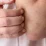 Itchy skin