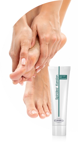 Calluses