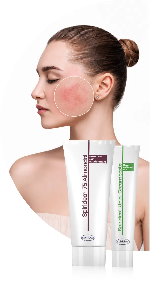 Irritated skin