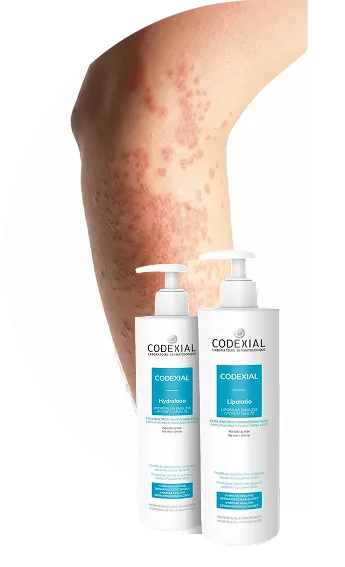 Dry and atopic skin
