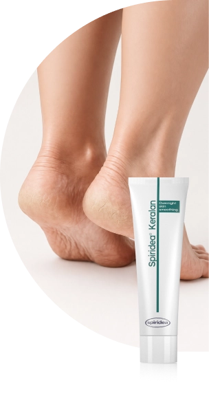 Thickened and callused skin